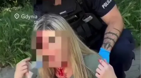 У Польщі затримали пенсіонера, який напав на українку в Гдині