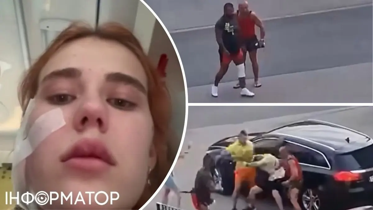 У Польщі троє поляків жорстоко побили українську пару через акцент