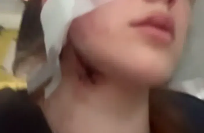 Генконсульство у Вроцлаві звернулося до поліції Польщі через напад на українців